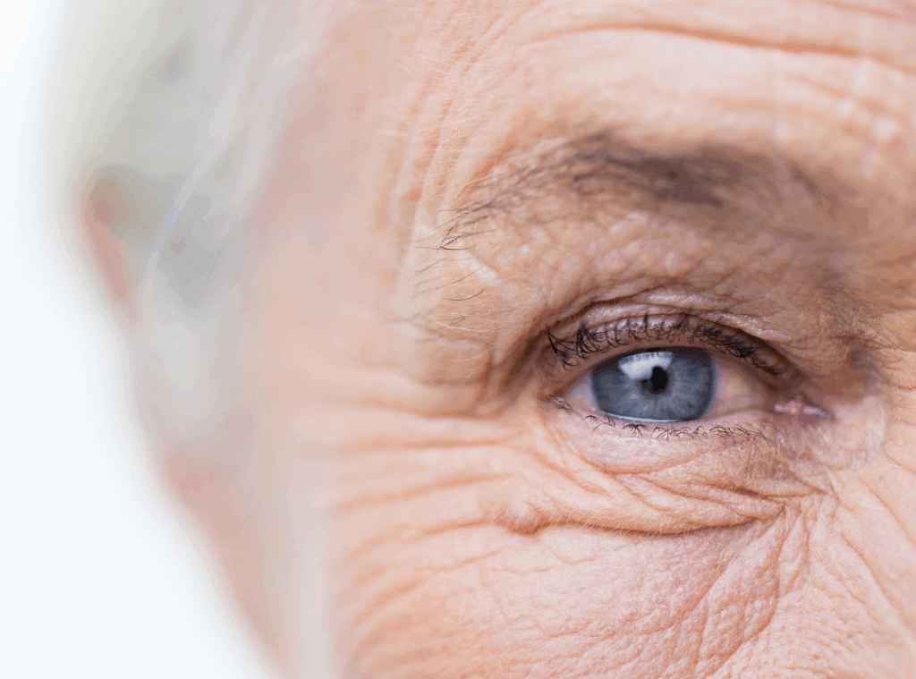 aging of the eye
