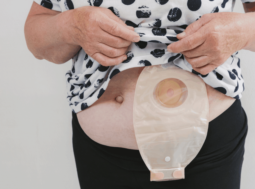 common bowel problems in the elderly